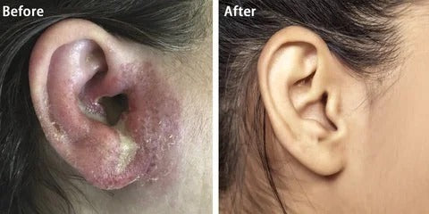 TINNITUS RELIEF SPRAY™ by Mediko